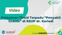 Pelayanan Tiroid Terpadu “Penyakit Graves” di RSUP dr. Kariadi