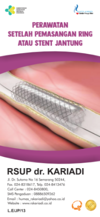 Perawatan Setelah Pemasangan Ring Atau Stent Jantung