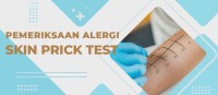 Video Edukasi “Pemeriksaan Skin Prick Test (SPT)”