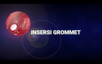 Video Pembelajaran “Insersi Grommet”